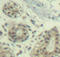 MDM2 Proto-Oncogene antibody, LS-C335021, Lifespan Biosciences, Immunohistochemistry paraffin image 