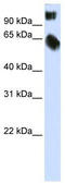 TSC22 Domain Family Member 2 antibody, TA334228, Origene, Western Blot image 