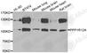 Protein Phosphatase 1 Regulatory Subunit 12A antibody, A6700, ABclonal Technology, Western Blot image 