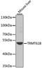 TRNA Methyltransferase 61B antibody, A8067, ABclonal Technology, Western Blot image 