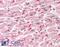 Junction Plakoglobin antibody, 45-076, ProSci, Immunohistochemistry paraffin image 