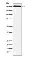 Myosin VIIA antibody, M03915, Boster Biological Technology, Western Blot image 