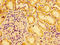Argonaute RISC Catalytic Component 2 antibody, LS-C372287, Lifespan Biosciences, Immunohistochemistry paraffin image 