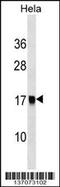 AP2S1 antibody, 59-195, ProSci, Western Blot image 