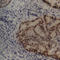 Hdm2 antibody, AM00224PU-T, Origene, Immunohistochemistry paraffin image 