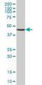 General Transcription Factor IIH Subunit 4 antibody, H00002968-B02P, Novus Biologicals, Western Blot image 