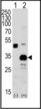 Neutrophil Cytosolic Factor 1 antibody, orb256708, Biorbyt, Western Blot image 
