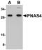 PPPDE peptidase domain-containing protein 1 antibody, A14424, Boster Biological Technology, Western Blot image 