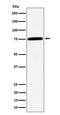 Protein Phosphatase, Mg2+/Mn2+ Dependent 1G antibody, M06725-2, Boster Biological Technology, Western Blot image 