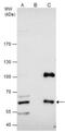 Cystathionine-Beta-Synthase antibody, NBP1-33518, Novus Biologicals, Immunoprecipitation image 