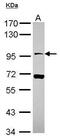 Neuroligin 4 X-Linked antibody, PA5-30776, Invitrogen Antibodies, Western Blot image 