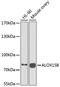 Arachidonate 15-Lipoxygenase Type B antibody, A6865, ABclonal Technology, Western Blot image 