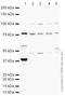 Acyl-CoA Synthetase Short Chain Family Member 2 antibody, ab66038, Abcam, Western Blot image 