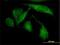 Rho Associated Coiled-Coil Containing Protein Kinase 2 antibody, H00009475-M02, Novus Biologicals, Immunofluorescence image 