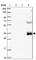 Globoside Alpha-1,3-N-Acetylgalactosaminyltransferase 1 (FORS Blood Group) antibody, HPA051298, Atlas Antibodies, Western Blot image 