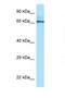 Phosphoglucomutase 2 antibody, NBP1-98407, Novus Biologicals, Western Blot image 