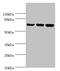 DEAD-Box Helicase 3 X-Linked antibody, A50189-100, Epigentek, Western Blot image 