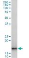 Translocase Of Outer Mitochondrial Membrane 22 antibody, H00056993-A01, Novus Biologicals, Western Blot image 