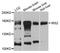 Insulin Receptor Substrate 2 antibody, STJ110254, St John