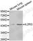 Interleukin 2 Receptor Subunit Gamma antibody, A1829, ABclonal Technology, Western Blot image 