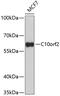 Twinkle protein, mitochondrial antibody, GTX53922, GeneTex, Western Blot image 