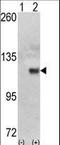 Hexokinase 1 antibody, LS-C101276, Lifespan Biosciences, Western Blot image 