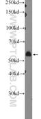 Pyruvate Dehyrogenase Phosphatase Catalytic Subunit 1 antibody, 21176-1-AP, Proteintech Group, Western Blot image 