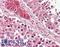 Glutathione Peroxidase 4 antibody, LS-B7835, Lifespan Biosciences, Immunohistochemistry paraffin image 