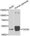 Tachykinin Receptor 3 antibody, A7220, ABclonal Technology, Western Blot image 