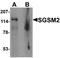 Small G Protein Signaling Modulator 2 antibody, orb137361, Biorbyt, Western Blot image 