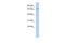 ClpB Homolog, Mitochondrial AAA ATPase Chaperonin antibody, 26-832, ProSci, Enzyme Linked Immunosorbent Assay image 