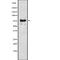 Receptor Interacting Serine/Threonine Kinase 1 antibody, abx147213, Abbexa, Western Blot image 