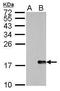 H2A Histone Family Member X antibody, GTX628789, GeneTex, Western Blot image 