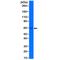 Keratin 5 antibody, M00398-3, Boster Biological Technology, Western Blot image 