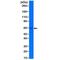 Keratin 5 antibody, M00398-3, Boster Biological Technology, Western Blot image 