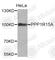 Protein Phosphatase 1 Regulatory Subunit 15A antibody, A5590, ABclonal Technology, Western Blot image 