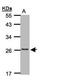 CKLF Like MARVEL Transmembrane Domain Containing 5 antibody, PA5-21946, Invitrogen Antibodies, Western Blot image 