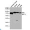 Protein Tyrosine Phosphatase Non-Receptor Type 6 antibody, LS-C813114, Lifespan Biosciences, Western Blot image 
