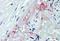 ADAM Metallopeptidase Domain 8 antibody, MBS242896, MyBioSource, Immunohistochemistry frozen image 