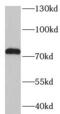 Transforming Growth Factor Beta Induced antibody, FNab08641, FineTest, Western Blot image 