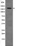 DNA Topoisomerase II Alpha antibody, PA5-64536, Invitrogen Antibodies, Western Blot image 