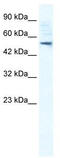 Sphingomyelin Phosphodiesterase Acid Like 3B antibody, TA334676, Origene, Western Blot image 