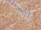 Adenosine Deaminase antibody, LS-C369170, Lifespan Biosciences, Immunohistochemistry paraffin image 