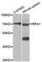 Replication Protein A1 antibody, STJ25385, St John