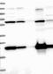 SEC24 Homolog D, COPII Coat Complex Component antibody, NBP1-81482, Novus Biologicals, Western Blot image 