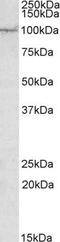 AP2 Associated Kinase 1 antibody, NBP1-45214, Novus Biologicals, Western Blot image 