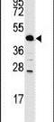 Acid Phosphatase, Prostate antibody, PA5-14545, Invitrogen Antibodies, Western Blot image 