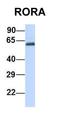 RAR Related Orphan Receptor A antibody, orb329792, Biorbyt, Western Blot image 