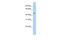 Erythroblast Membrane Associated Protein (Scianna Blood Group) antibody, A08759, Boster Biological Technology, Western Blot image 