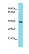 Coiled-Coil Domain Containing 86 antibody, orb326747, Biorbyt, Western Blot image 